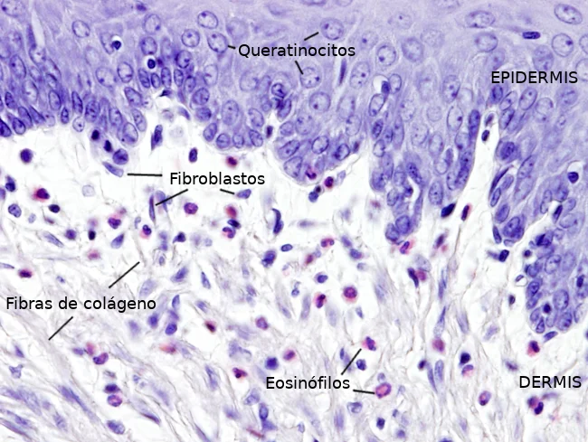 Diferencia entre fibroblastos y fibrocitos