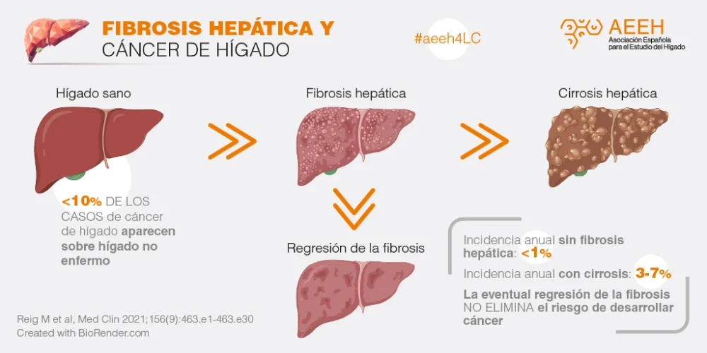 Diferencia entre fibrosis y cirrosis