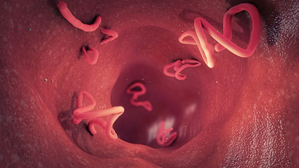 Diferencia entre la tiña y la lombriz intestinal