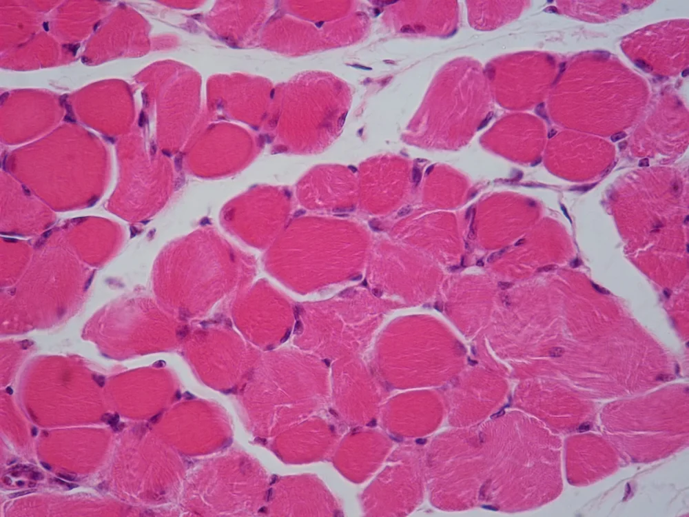 Diferencia entre sincitio y cenocítico