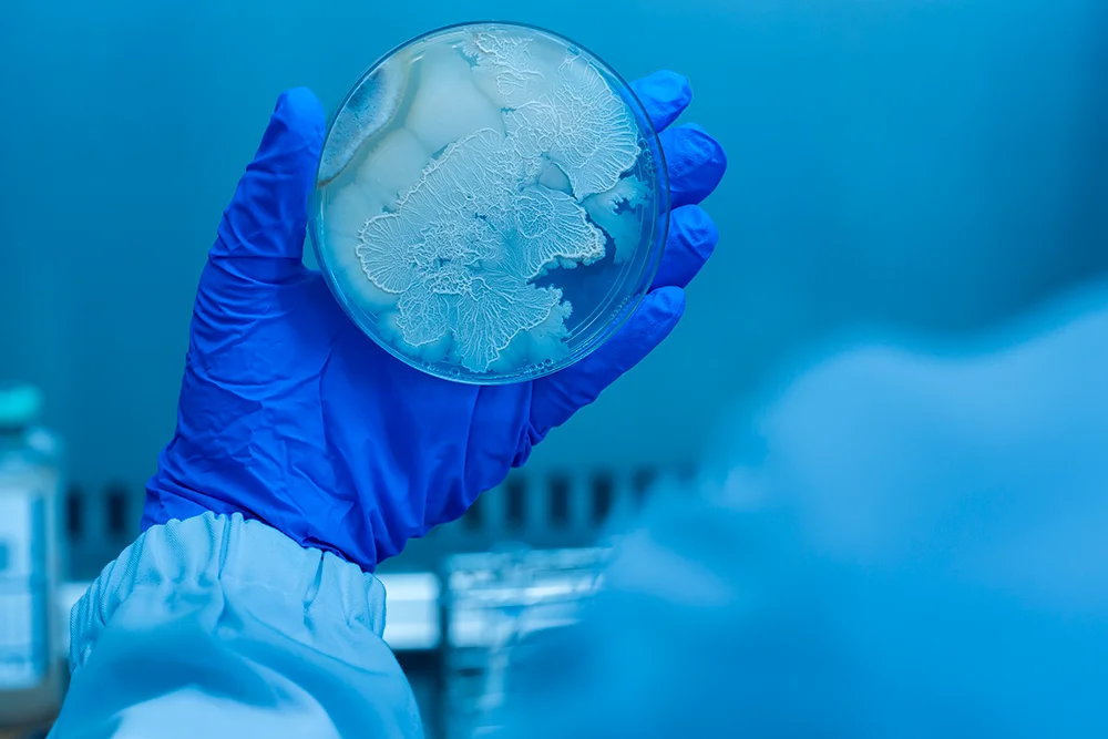 Diferencia entre agar y agar noble