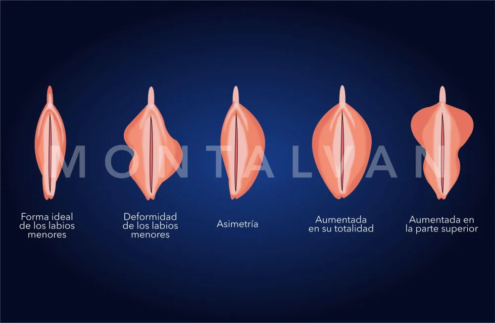 Diferencia entre labios y vulva