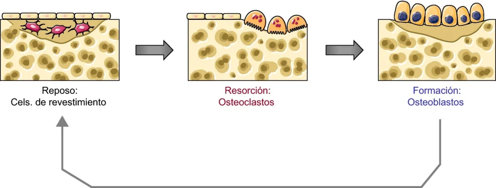 Diferencia entre osteoblasto y osteoclasto