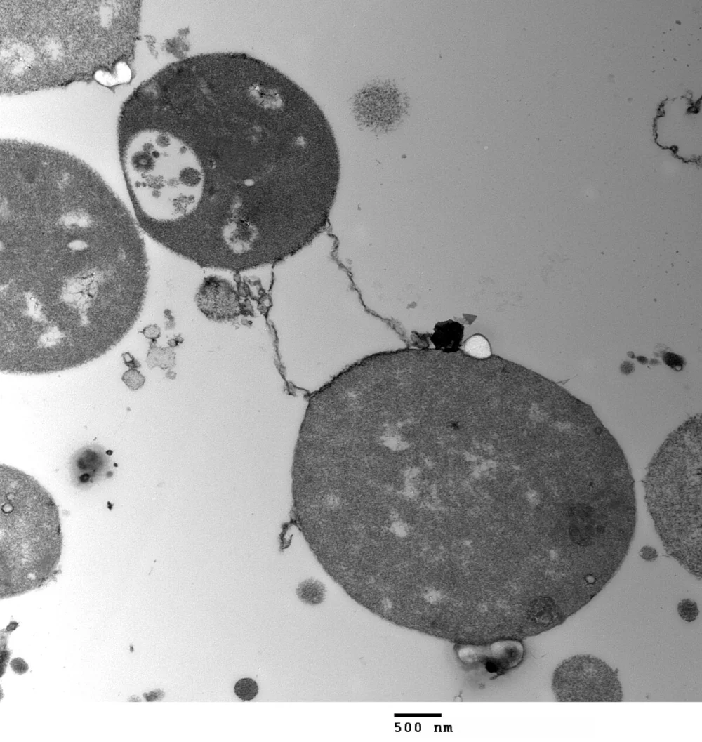Diferencia entre las bacterias en forma L y el micoplasma