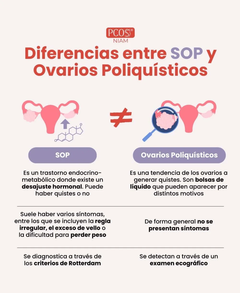Diferencia entre SOP y POS