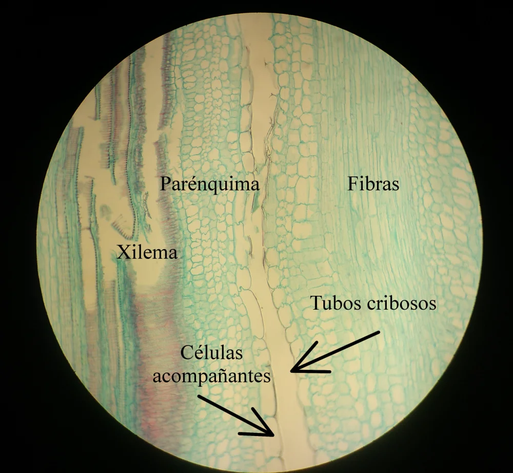Diferencia entre las celdas cribosas y los tubos cribosos