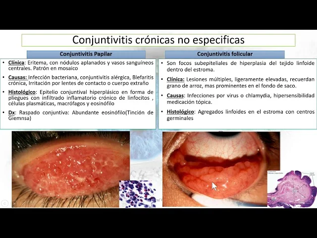 Diferencia entre papilas y folículos