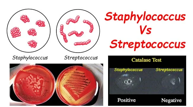 Diferencia entre Staphylococcus aureus y Streptococcus pyogenes