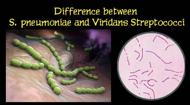 Diferencia entre Streptococcus pneumoniae y Streptococcus viridans