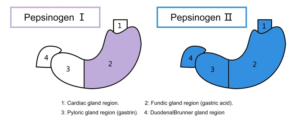 Diferencia entre pepsina y pepsinógeno
