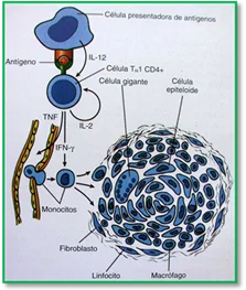 Diferencia entre tejido de granulación y granuloma