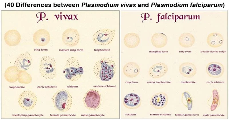Diferencia entre Plasmodium falciparum y Plasmodium vivax