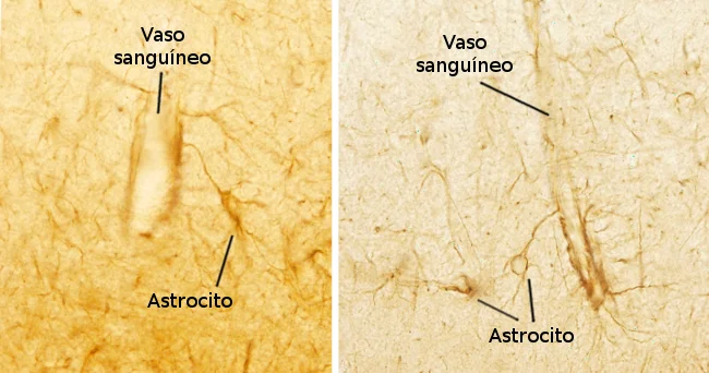 Diferencia entre los astrocitos fibrosos y protoplásmicos