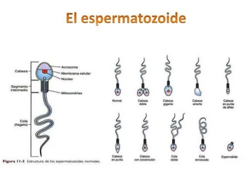 Diferencia entre los espermatozoides indiferenciados y los espermatozoides