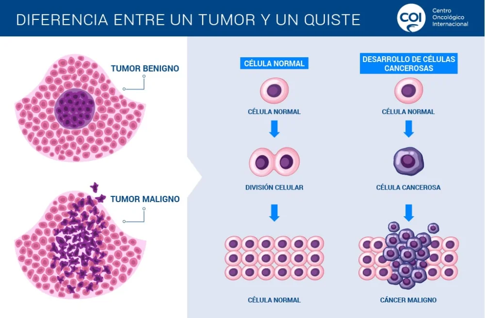 Diferencia entre tumor y cáncer