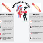 Diferencia entre angina e isquemia