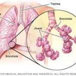 Diferencia entre bronquiolos y alvéolos