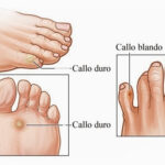 Diferencia entre callo y plántula