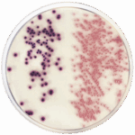 Diferencia entre E. coli y coliformes