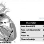 Diferencia entre el nodo SA y el nodo AV