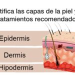 Diferencia entre epidermis e hipodermis