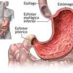 Diferencia entre esfínter y válvula