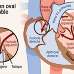 Diferencia entre fosa y foramen