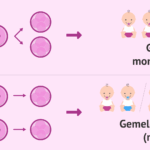 Diferencia entre gemelos monocigóticos y dicigóticos