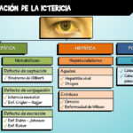 Diferencia entre ictericia e ictericia