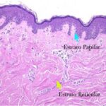 Diferencia entre la dermis papilar y la reticular