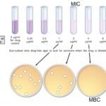 Diferencia entre MIC y MBC