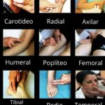 Diferencia entre pulso apical y radial