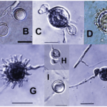 Diferencia entre Pythium y Phytophthora