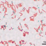 ¿Por qué se utiliza calor en la tinción de endosporas?