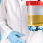 ¿Qué causa los niveles altos de cortisol en la orina?