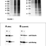 Diferencia entre acrilamida y bisacrilamida Ciencia