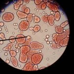 Diferencia entre coacervado y microesfera