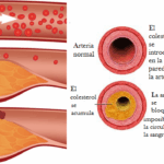 Diferencia entre colesterol y triglicéridos