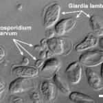 Diferencia entre Cryptosporidium y Giardia