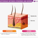 Diferencia entre dermis y epidermis