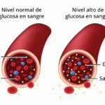 Diferencia entre el azúcar en sangre y la glucosa