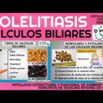 Diferencia entre el colesterol y los cálculos biliares pigmentados