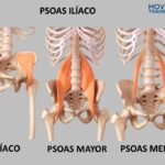 Diferencia entre el psoas y el flexor de la cadera
