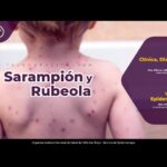 Diferencia entre el sarampión y la rubéola