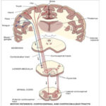Diferencia entre el tracto corticoespinal anterior y lateral