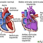 Diferencia entre el ventrículo izquierdo y el derecho