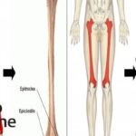Diferencia entre fémur y húmero