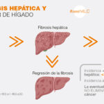 Diferencia entre fibrosis y cirrosis