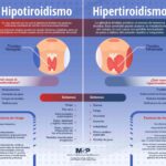 Diferencia entre hipotiroidismo e hipertiroidismo