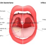 Diferencia entre la amígdala izquierda y la derecha